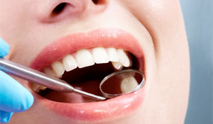 composite filling - calgary dentist